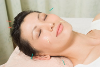 đau đầu vận mạch có châm cứu được không?
